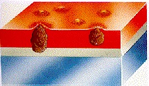 zapylenie